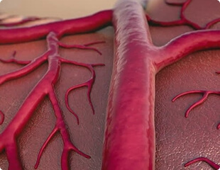 Vasos sanguíneos frágeis e danificados pela hipertensão